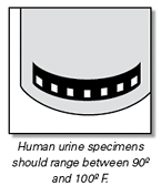 Urine temperature